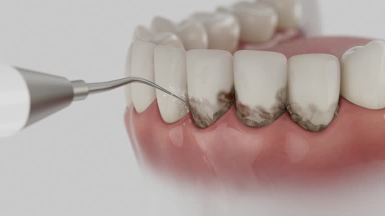 Trusted Teeth Cleaning And Checkup service in Oakland, NE - Dentist Open Now